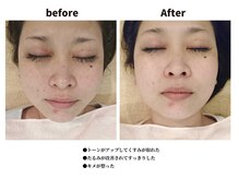 コラソン(CORAZON)/毎月１回スペシャルケアを★