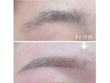 ナチュラルでふわっと眉毛を間引きで“つくりこむ”眉毛矯正