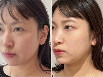 アンバイアオ 本町(UN by ao.)/まつげパーマ+眉ワックス