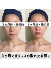 お顔の研究所/ビフォーアフター写真♪