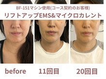 サボラミ(sabor A Mi)の雰囲気（40歳女性/『リフトアップEMS&マイクロカレント』20回コース）