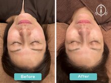 アイ(i)/ビフォーアフター