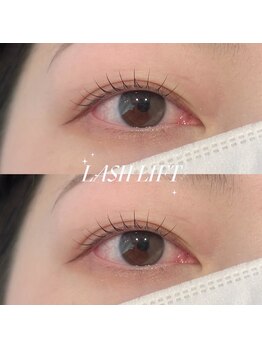 ビオラス(Biolus)/まつげパーマ/ラッシュリフト