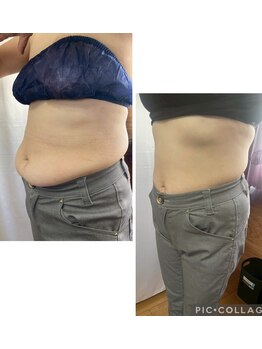 アクアモア/アクアモアの痩身★BeforeAfter