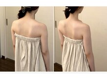 アマリエ/before after