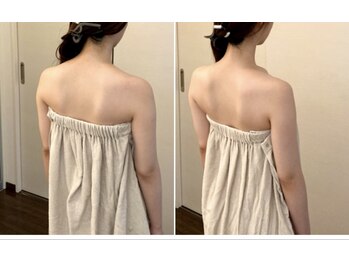 アマリエ/before after