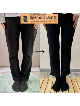 横浜DRT矯正院/O脚矯正