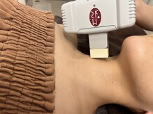 エイミー なんば店(ei-me)/【脱毛サロン/全身脱毛】首脱毛