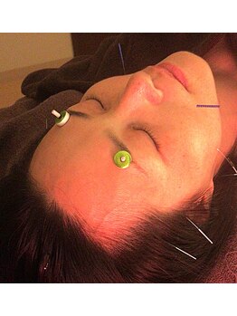 フィットジユウガオカ(Fit_Jiyugaoka)/いくつからでも美容鍼灸