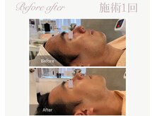 パルタージュ(Partage)/