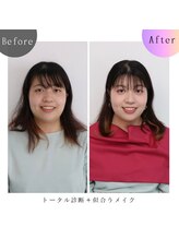 シュアリー(Surely)/ペアトータルコースお客様事例