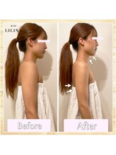 ウィズリリナ 新横浜(with Lilina.)/小顔頭蓋骨矯正/巻き肩矯正/一回