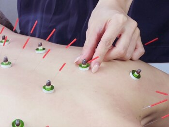 馬場3丁目整骨院/オーダーメイド鍼きゅう+整体