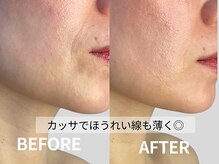 ドクタープラント 北心斎橋店(DR PLANT)の雰囲気（不調やお悩みに合ったカッサケアで体の中から巡りを整え根本改善）