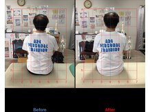 ストレチックス 近江八幡店/姿勢改善ビフォーアフター1回