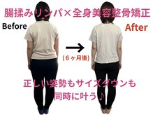 エムケーサロン(Mksalon)/全身美容整骨矯正モニター