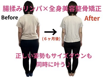 エムケーサロン(Mksalon)/全身美容整骨矯正モニター