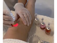 ルメラ/膝・施術風景