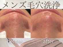 ラグレ(LUXRE)/メンズも毛穴洗浄！