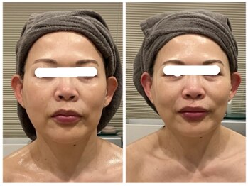 シェルハ(XEL-HA)/１回の効果