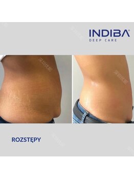 賢者のボディケア/お腹の健康痩せトリプルコース☆