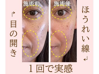 オワゾーブルー(Oiseaubleu)/スタッフの変化