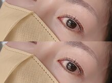 ルークスネイル(LOCUS NAIL)/