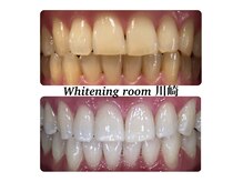 ホワイトニングルーム 川崎店(WhiteningRoom)の雰囲気（セルフホワイトニング未経験でも◎スタッフがサポートします♪）