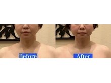 アジール 新潟市(agir)/Before/After画像