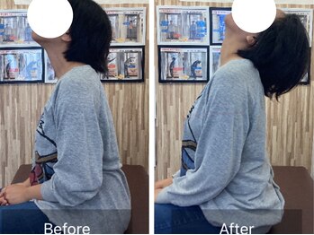 ナオル整体 札幌院(NAORU整体)/札幌円山/整体/猫背/姿勢矯正