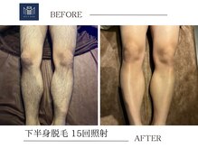 メンズメイド(Mens'Made)/before /after