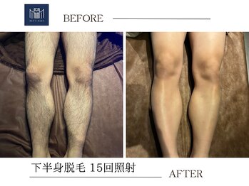 メンズメイド(Mens'Made)/before /after