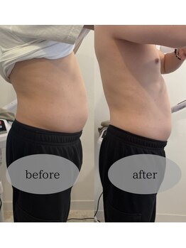 マホロバ セカンド(mahoroba 2nd)/くびれスッキリ腸マッサージ