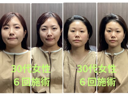 ハナレ(HANARe)の写真