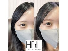 ハリウッドブロウリフト