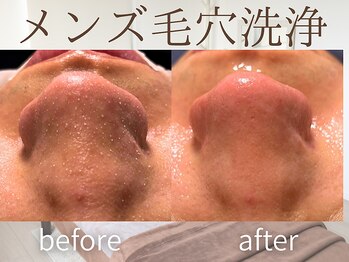 ラグレ(LUXRE)/メンズ毛穴洗浄