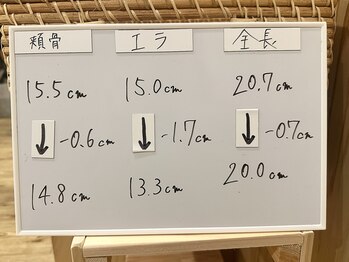 美整庵 谷山店(BISEIAN)/エラ－1.5cmの写真