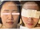 ミエリア美容鍼灸院(mielia美容鍼灸院)の写真