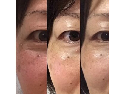 ブリスルーチェ(Bliss luce)の写真