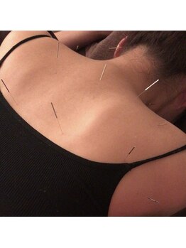 フィットジユウガオカ(Fit_Jiyugaoka)/リラクゼーションに特化する鍼