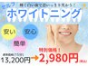 【セルフホワイトニング】白い歯で好印象♪初回限定15分照射が2,980円！！
