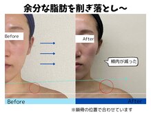 お顔の研究所/ビフォーアフター写真♪