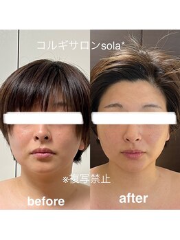 ソラ(sola*)/フェイスラインの革命