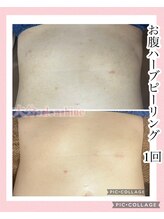 サロンシャイン(Salon Shine)/お腹のハーブピーリング１回