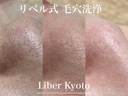 エステティック リベル キョウト 京都駅前店(Esthetic Liber Kyoto)の写真