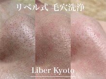 エステティック リベル キョウト 京都駅前店(Esthetic Liber Kyoto)