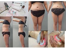 ルミルナ(Lumi Luna)の雰囲気（【大幅ダイエットにも！】本確痩身でガッツリ結果出し！）