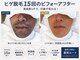 モア 公津の杜(MORE)の写真
