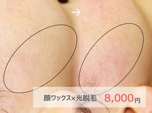 ピミル(PIMIL)