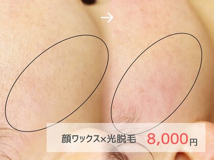 ピミル(PIMIL)の写真